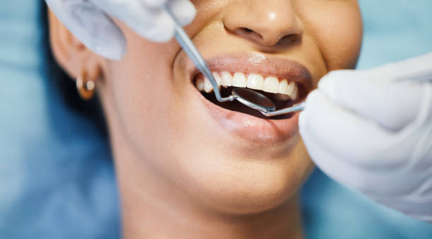 Best Emergency Dentist for Knocked-Out Tooth in Brookings, OR