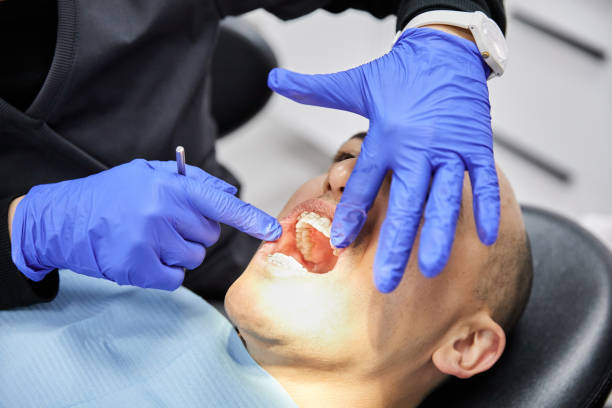 Best Emergency Dentist for Lost Fillings or Crowns in Brookings, OR